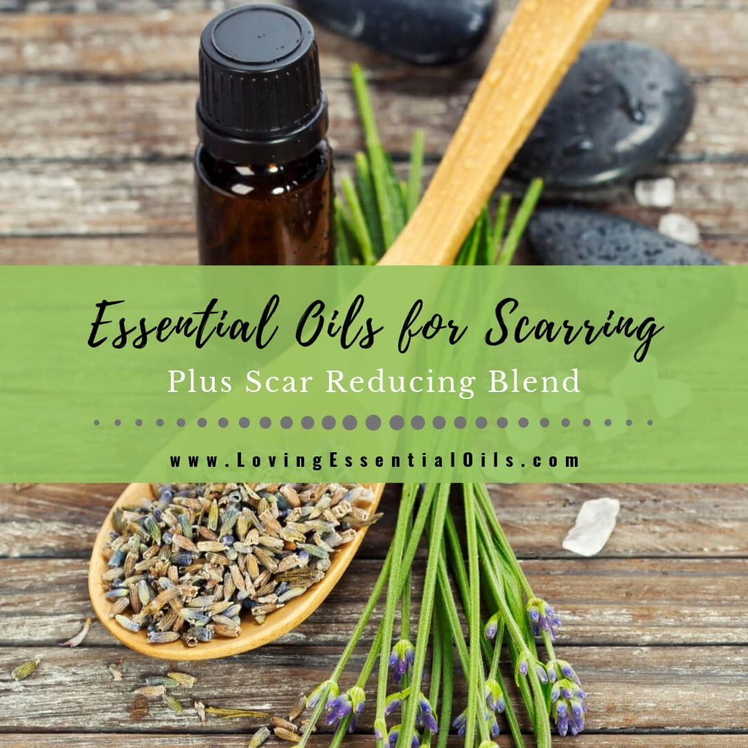 6 Best Essential Oils for Scarring with Scar Reducing Blend by Loving Essential Oils