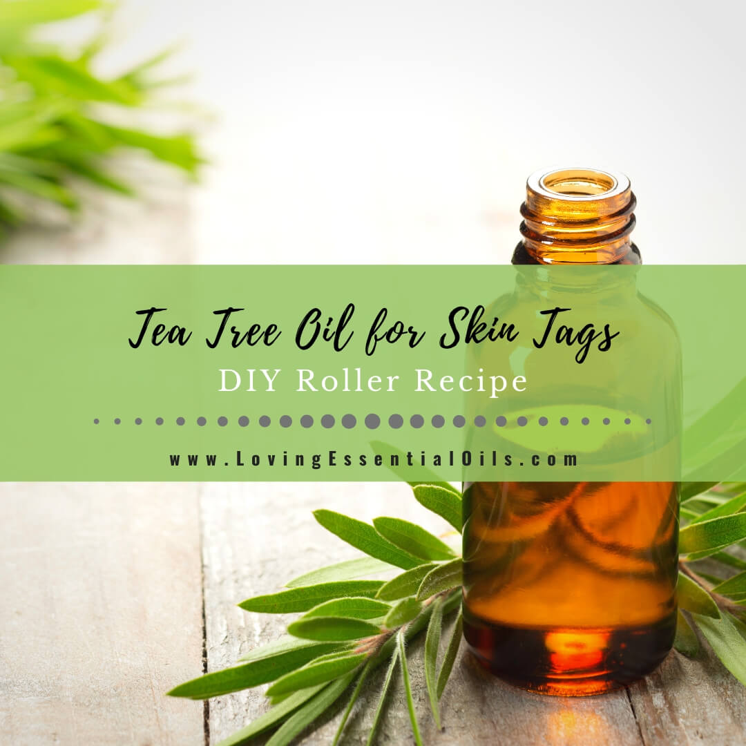 Tea Tree Oil for Skin Tags with DIY Roller Blend Recipe by Loving Essential Oils